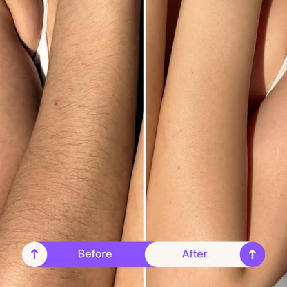 Sensitive Body Hair Removal Cream – 7-Day Smoothness